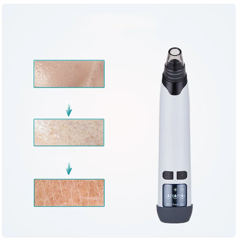 Blackhead Remover