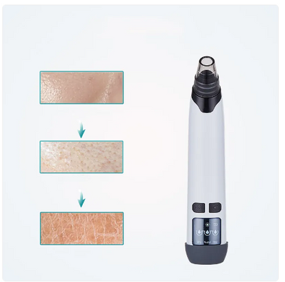 Blackhead Remover